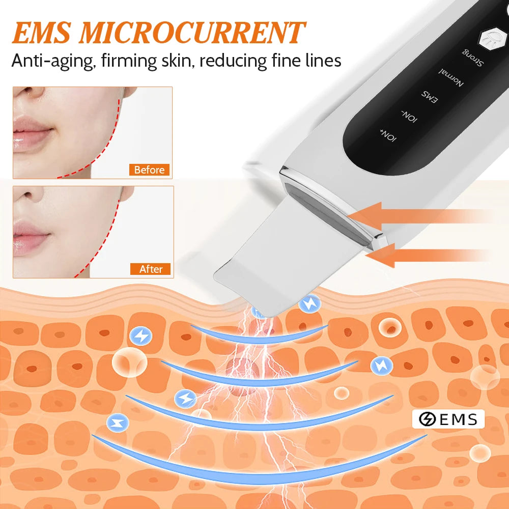Espátula Ultrasónica Facial Pro ✨ | Limpieza Profunda y Peeling con 4 Modos