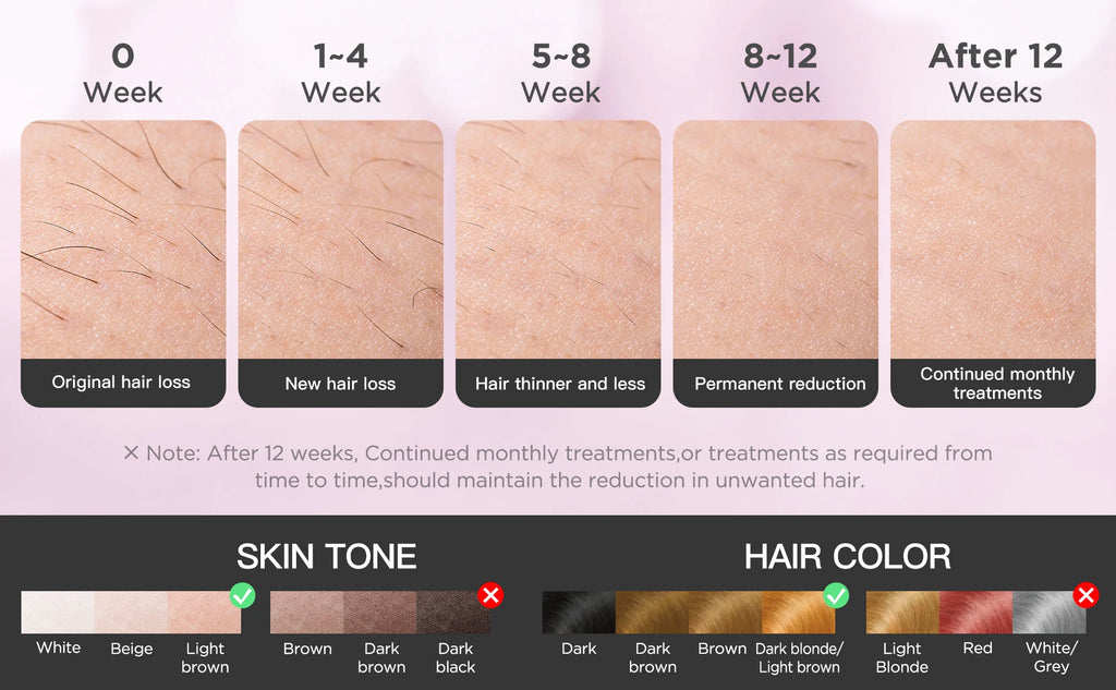Depiladora IPL INNZA Pro ✨ | Enfriamiento Ice Cooling y 999.999 Pulsos