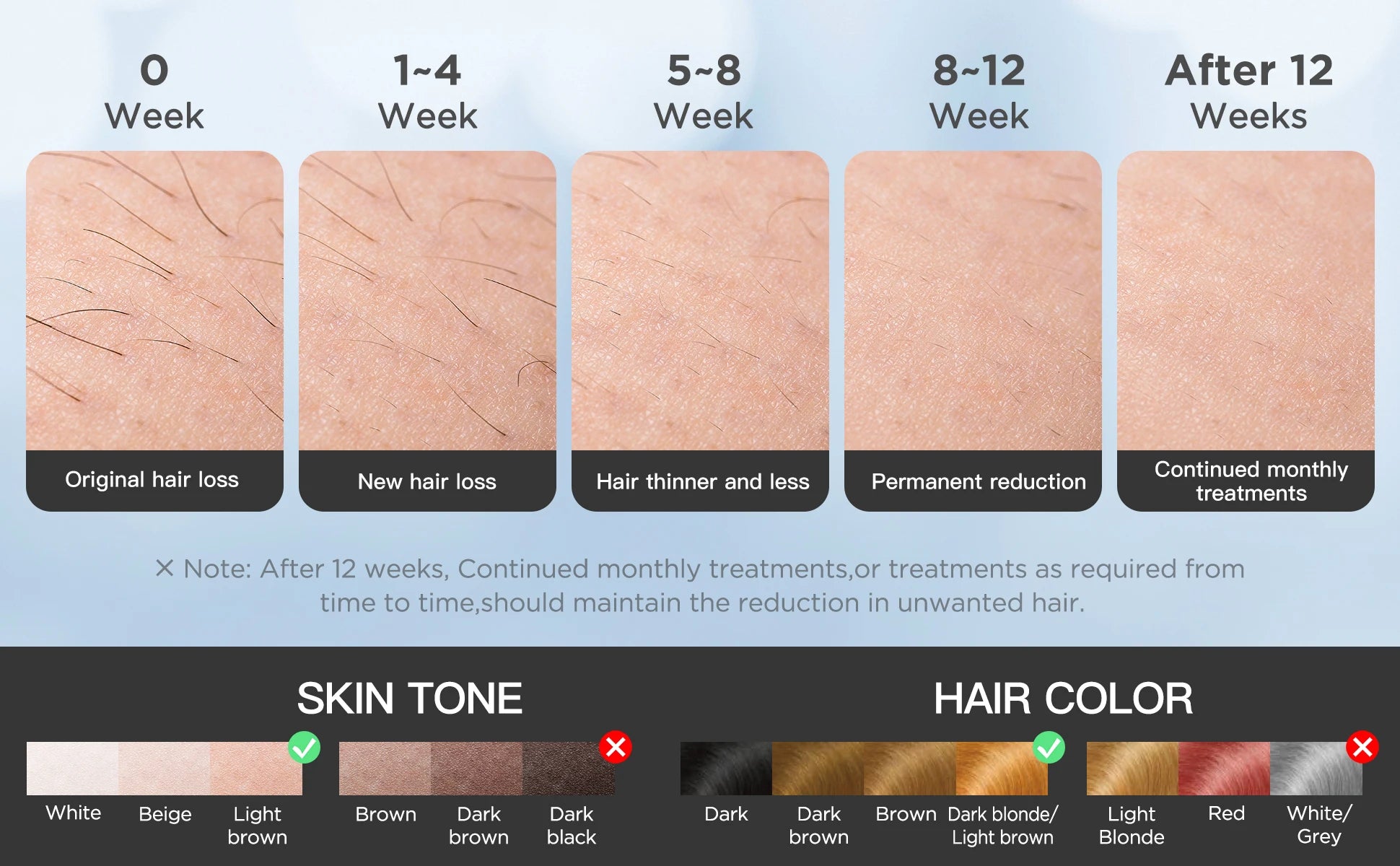 Depiladora IPL INNZA Pro ✨ | Enfriamiento Ice Cooling y 999.999 Pulsos