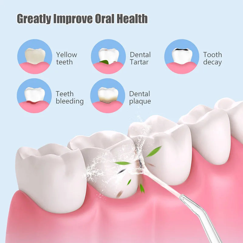 Irrigador Bucal Portátil Pro ✨ | Limpieza Dental IPX7 Recargable