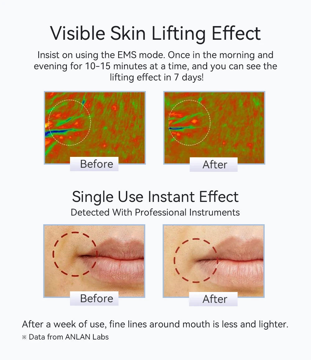 Masajeador Facial Microcorriente Pro ✨ | Terapia LED y Efecto Frío Rejuvenecedor