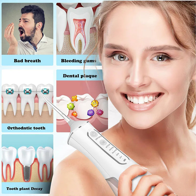 Irrigador Bucal Portátil Pro ✨ | Limpieza Dental IPX7 Recargable