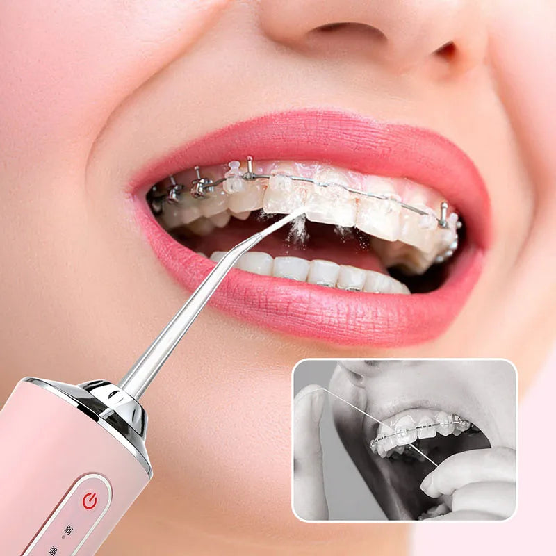 Irrigador Bucal Portátil Pro ✨ | Limpieza Dental IPX7 Recargable