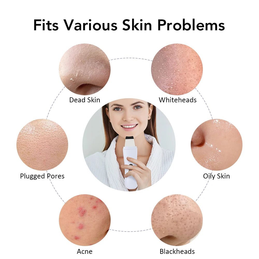 Espátula Ultrasónica Facial Pro ✨ | Limpieza Profunda y Peeling con 4 Modos